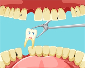 When Is a Tooth Extraction Necessary Signs You Shouldn't Ignore