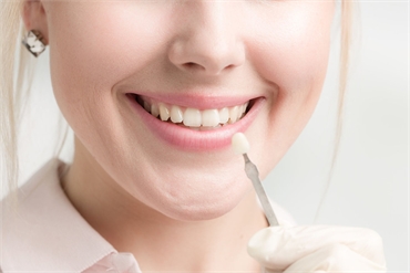 Tips for Preparing for a Dental Veneers Procedure in Seattle WA