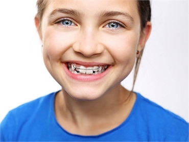 Understanding Orthodontic Therapy and Common Appliances