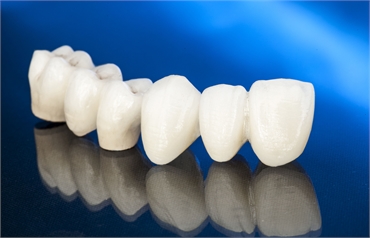 All Ceramic Crowns