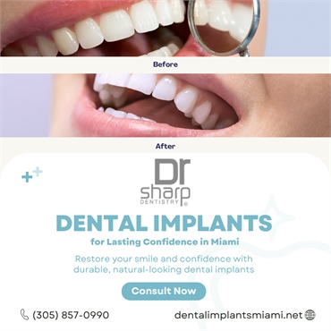 Why Dental Implants in Miami Are the Ideal Solution for a Perfect Smile