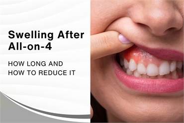 Swelling After All on 4 How Long and How to Reduce It