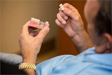 Dental implants model at Clearwater Dental Associates