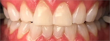 Dentistry of Poulsbo