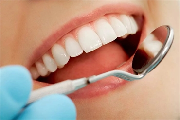 How Do You Maintain A Bright Smile After Teeth Whitening