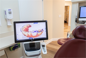 CEREC scanner for same day dental crowns at Sunnyvale dentist Derek H. Tang DDS