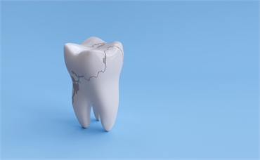 The Dangers of Ignoring a Broken Tooth and What You Need to Know