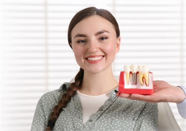 How Long Do Dental Implants Last