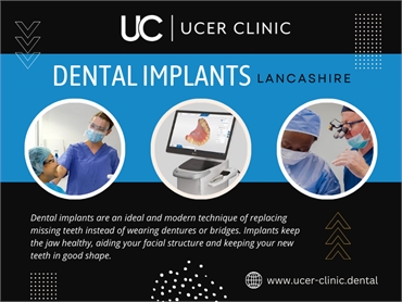 Dental Implants in Lancashire