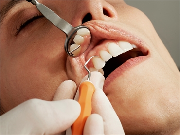 The Importance of Regular Dental Checkups What to Expect