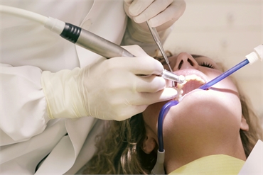 What to Expect at Your Dental Cleaning