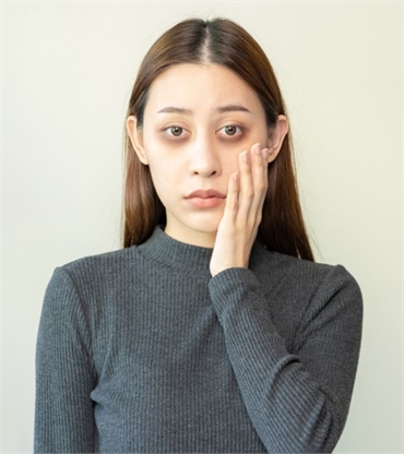 How Often Should You Repeat Dark Circle Treatments 