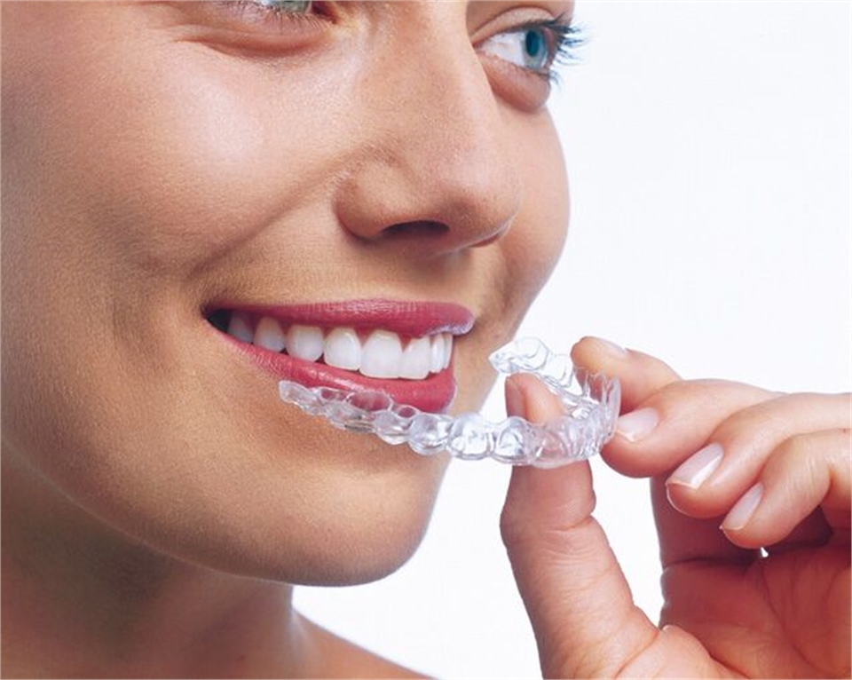 Invisalign in Melbourne