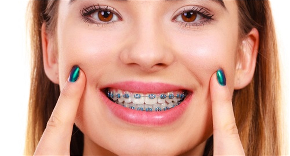 Braces Orthodontics Pediatrics- bop BRACES