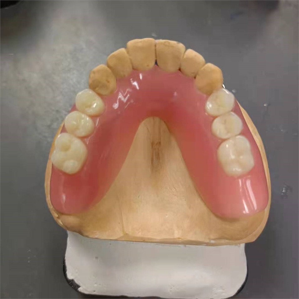 Acrylic denture 