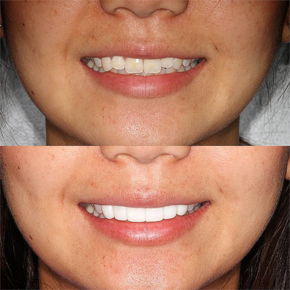 North Sydney Dental Braces