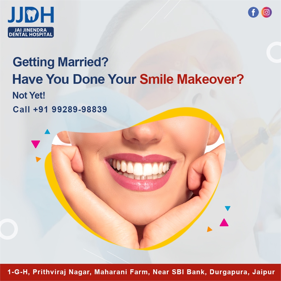 Bridal SmileMakeover