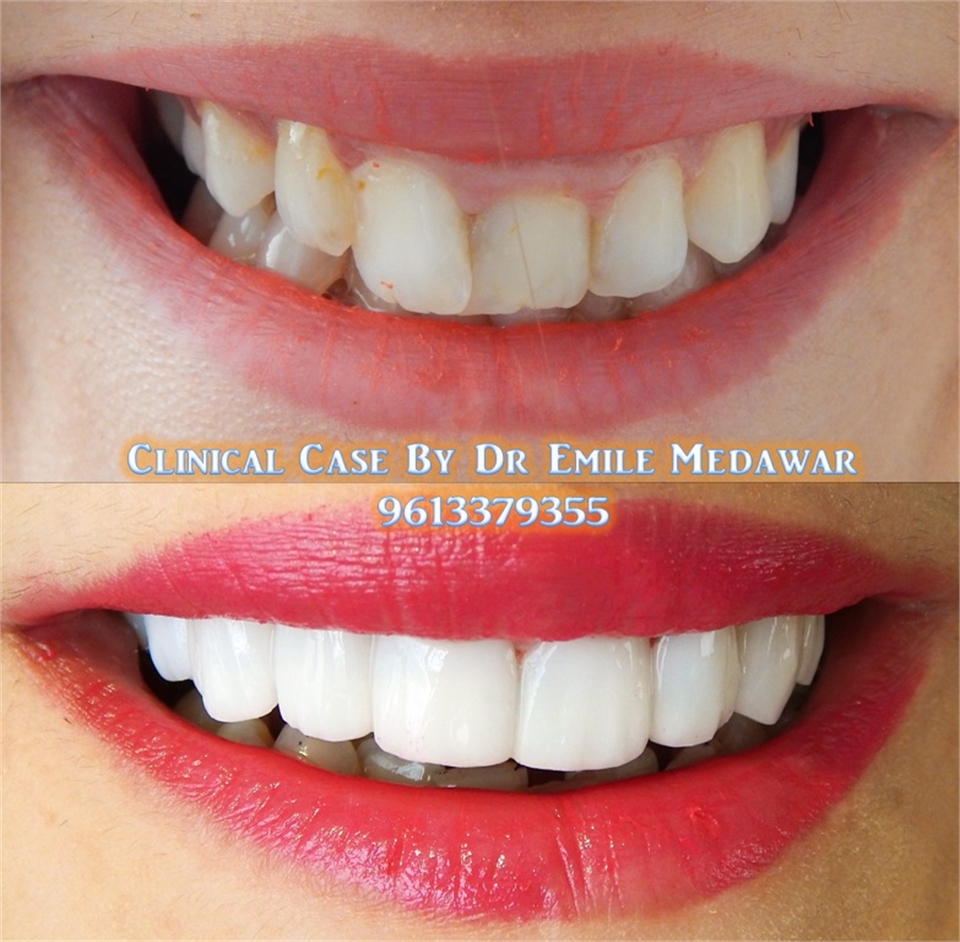 dentist lebanon beirut Dentagama