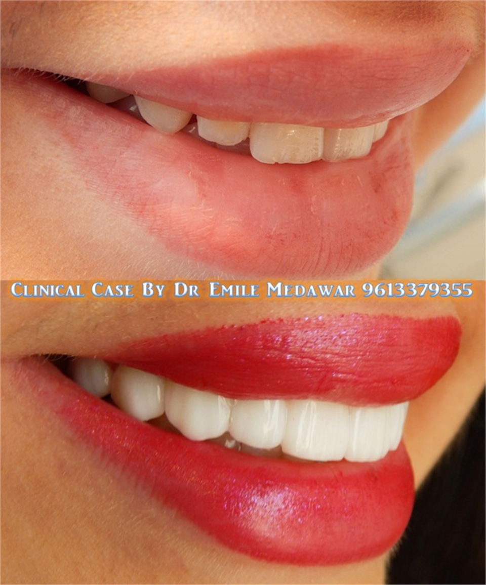 dental clinic lebanon beirut