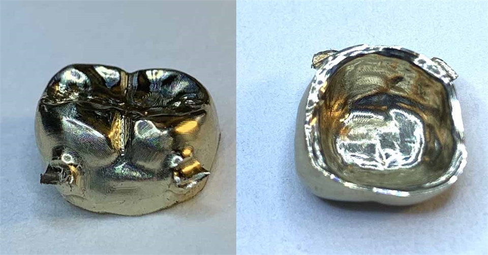 Milled Gold Crown Dentagama