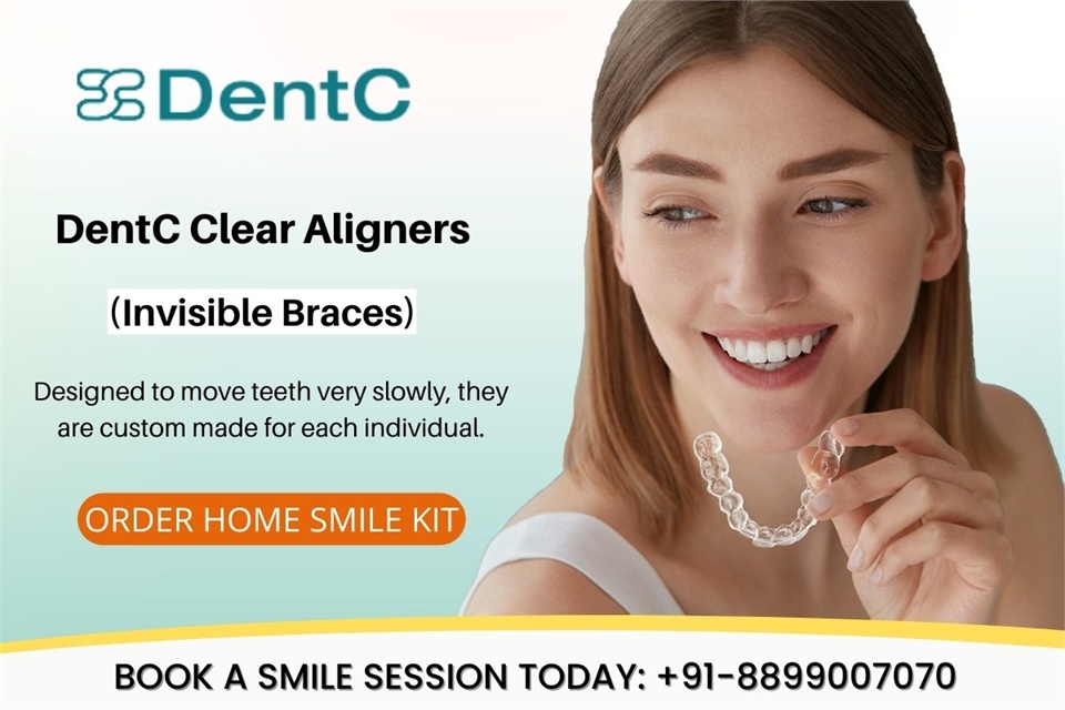 Best Clear Invisible Aligners