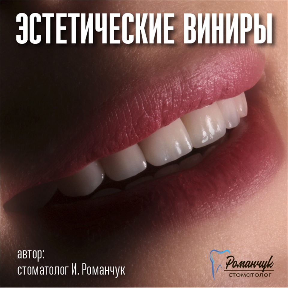 dental-veneers-6