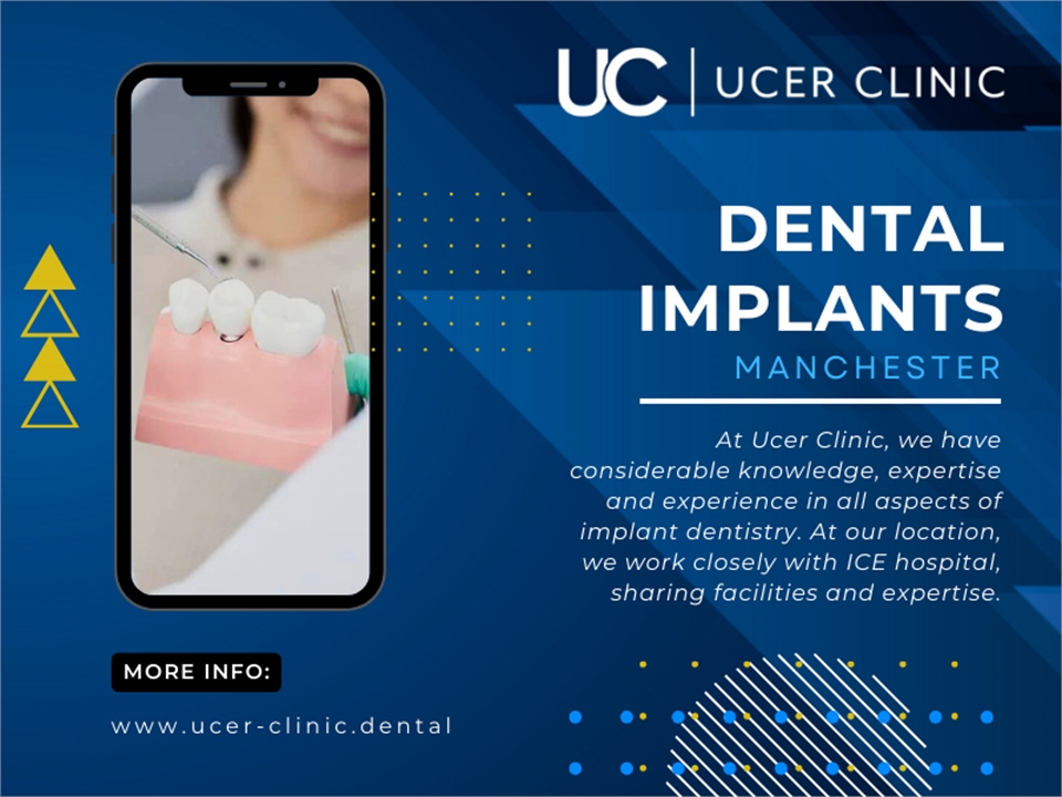 Dental Implants in Manchester