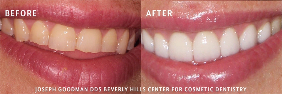 Beverly Hills Holistic Dentist