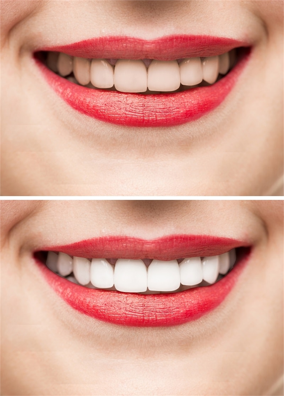 Cosmetic Dentistry Albuquerque NM