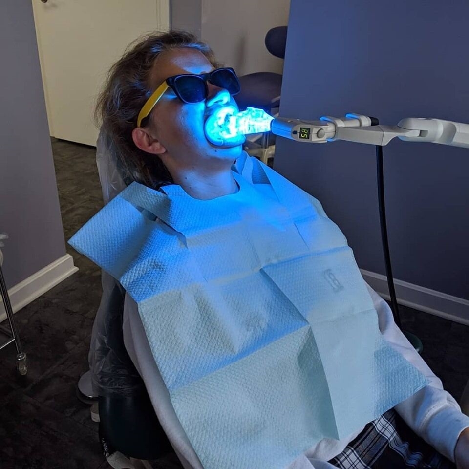 Teeth whitening procedure at Canton dentist Danner Dental