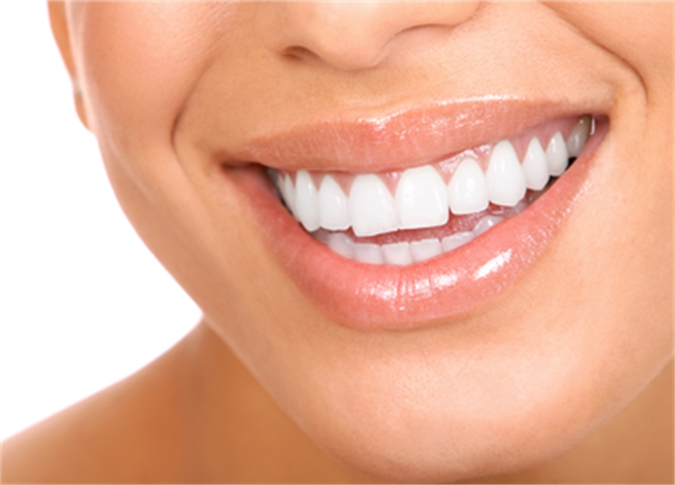 Teeth-Whitening-in-Sydney