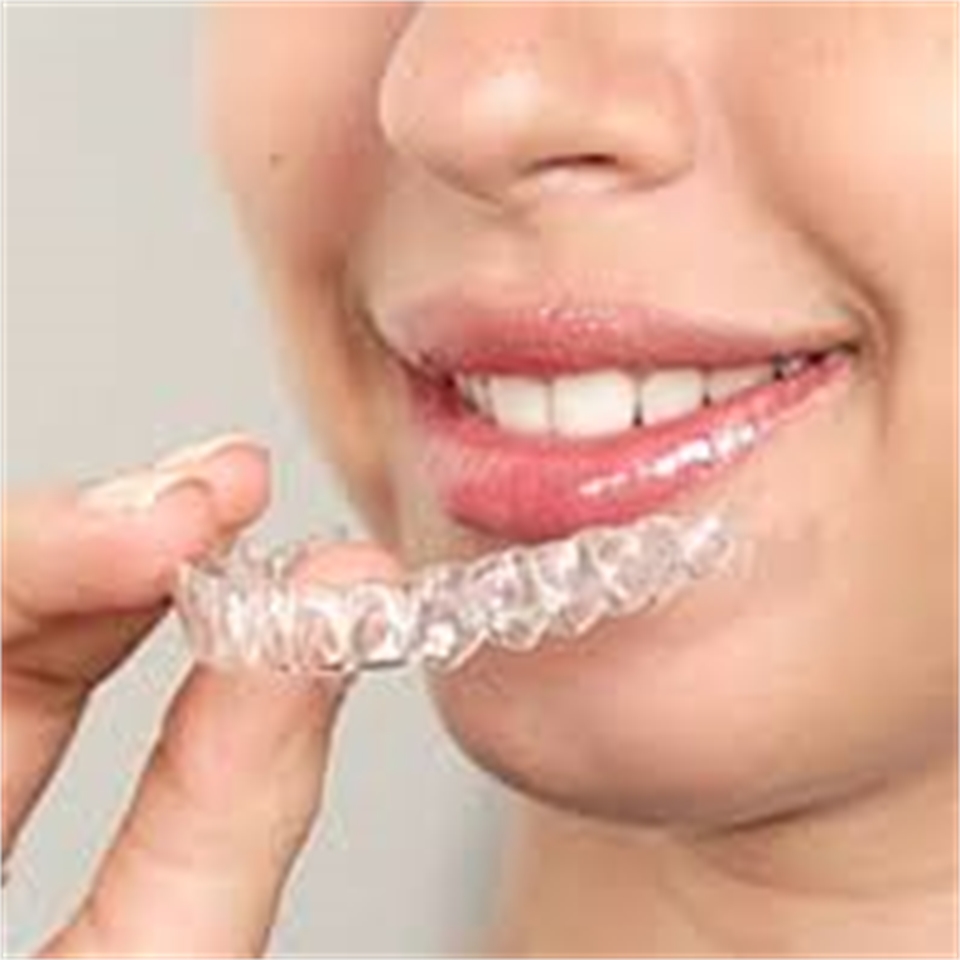 Clear Aligners