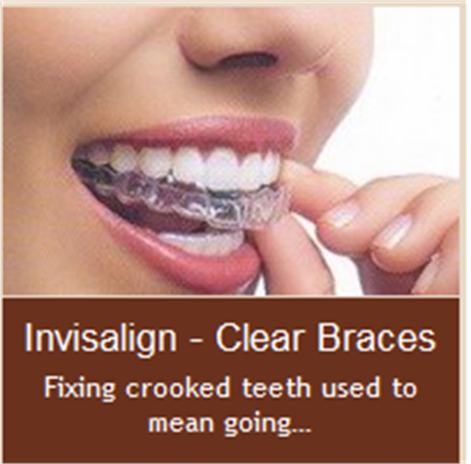 Invisalign Dentagama