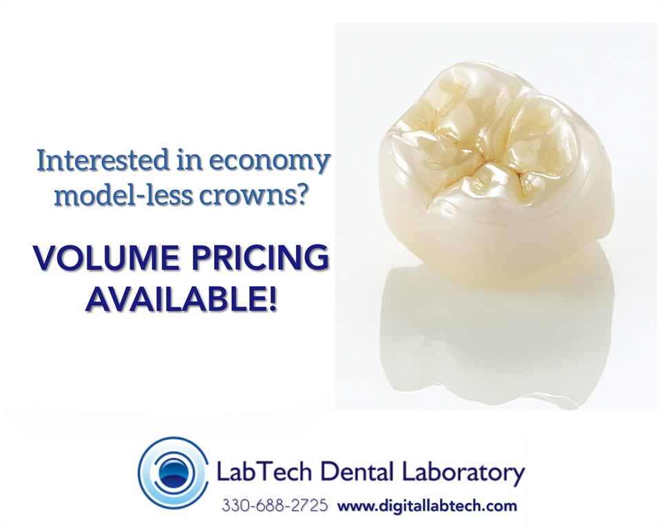 Model-less zirconia crown