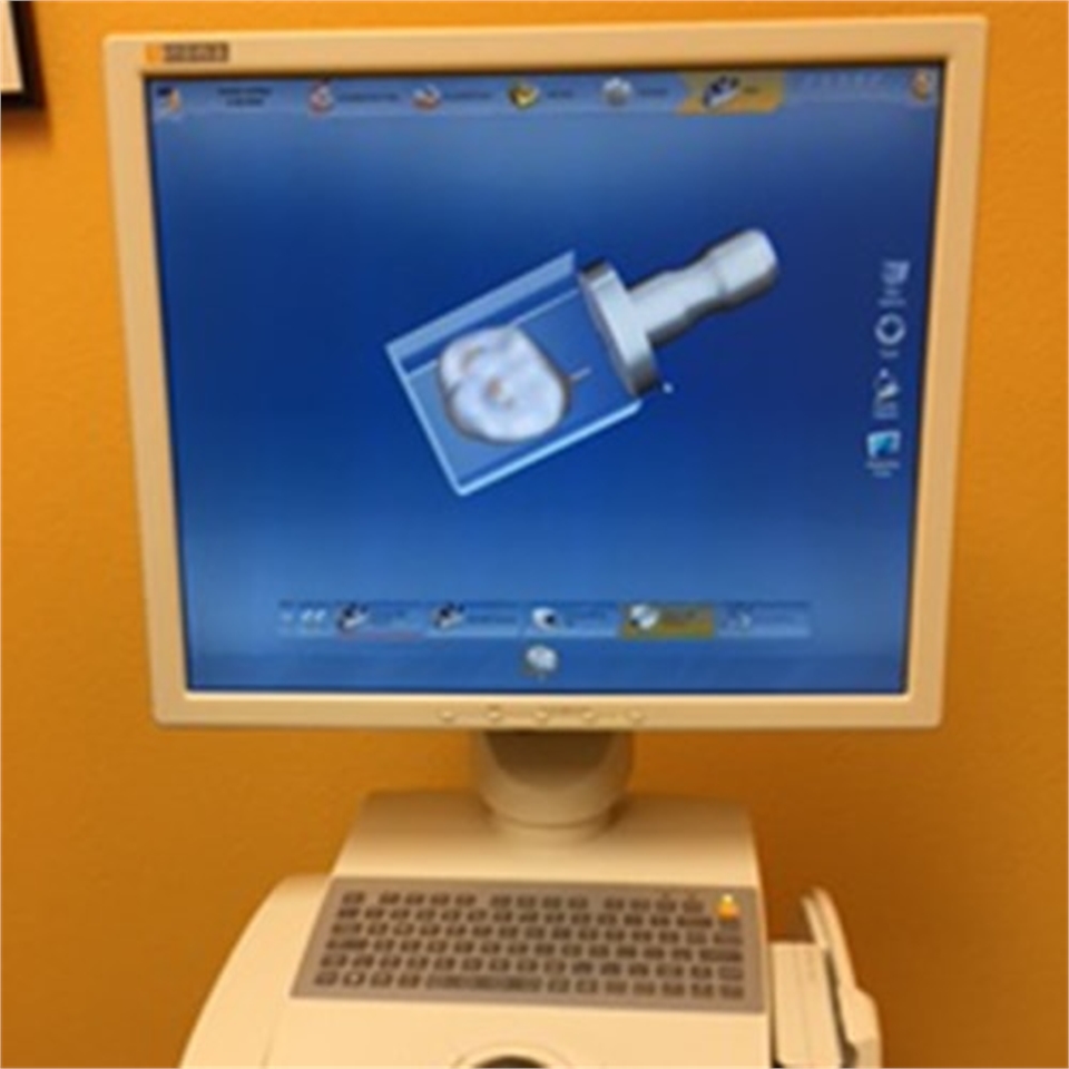 CEREC at Longmont CO dentist Artistic Smiles Dentagama