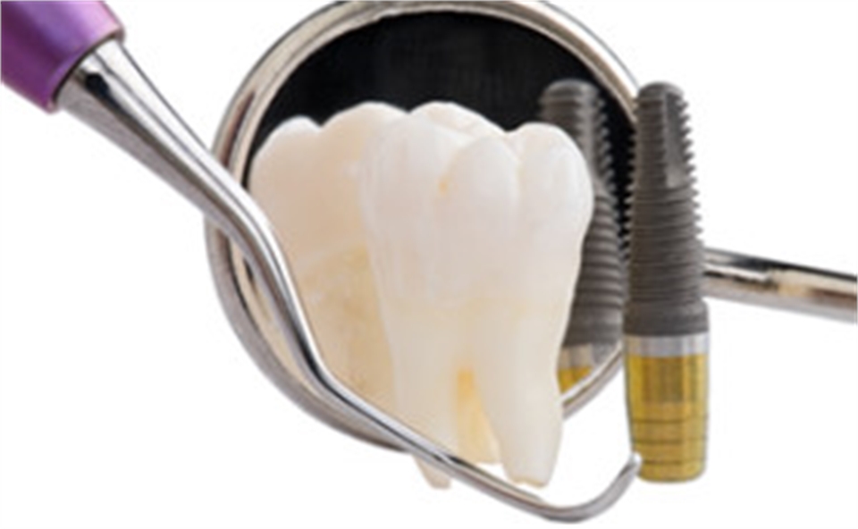 Affordable Dental Implants Melbourne