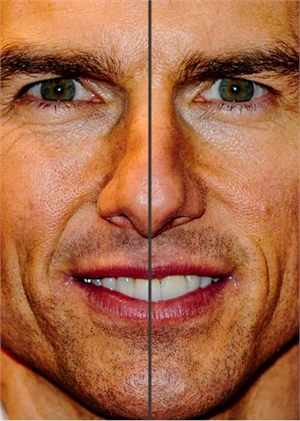 Actor Tom Cruise teeth midline shift