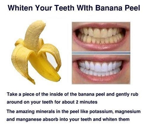 Teeth whitening with banana peel is not effective. The grittiness you feel while rubbing the banana peel is due to presence of tannins that react with the proteins on the teeth surface