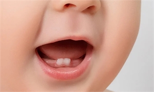 4 Ways To Keep Your Child Free from Dental Problems