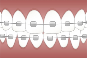 Dental braces educating cartoon