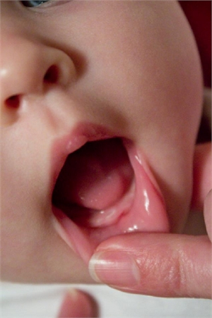 Teething in babies can cause discomfort