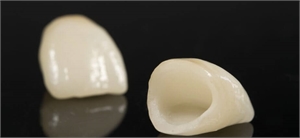 Pressed ceramic dental crowns 