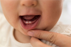 Do newborns need oral care?