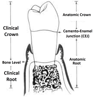 What is the difference between clinical crown and anatomic crown? What is the difference between clinical tooth root and anatomic tooth root? Crown-to-root ratio