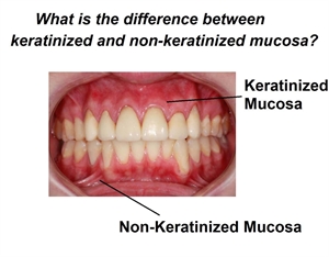 What is the difference between keratinized and non-keratinized mucosa?