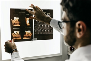 Dentist reviewing CT scanned teeth to determine diagnosis and treatment plan