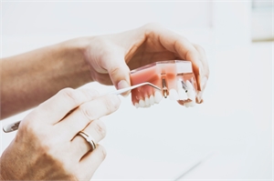 Dentist showing dental implant on a educational teeth model