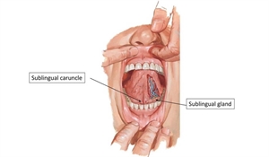 Location of the sublingual caruncle - under the tongue