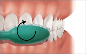 Fones tooth brushing technique for anterior teeth - the patient presses the bristles lightly on the teeth and moves the toothbrush in circular motions