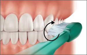 Fones tooth brushing technique for posterior teeth. It is also known as circular/scrub brushing method. The patient moves the toothbrush bristles in circular motions